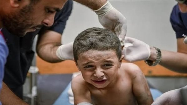 الدعاء لاطفال غزة الجرحى ..”اللهم احفظ الأطفال الجرحى وأعنِهم”